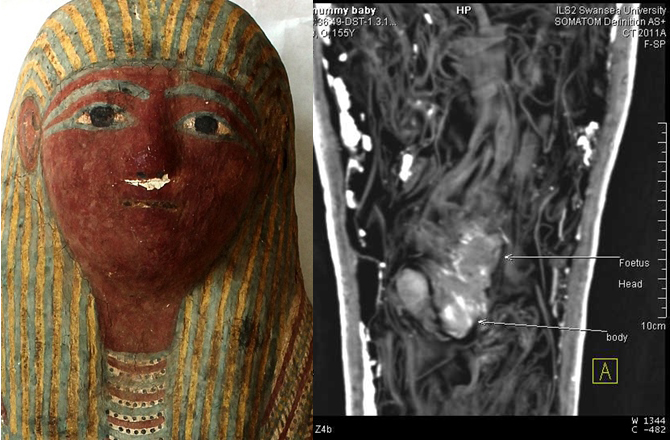 Mummified Fetus Found in Tiny Ancient Egyptian Sarcophagus