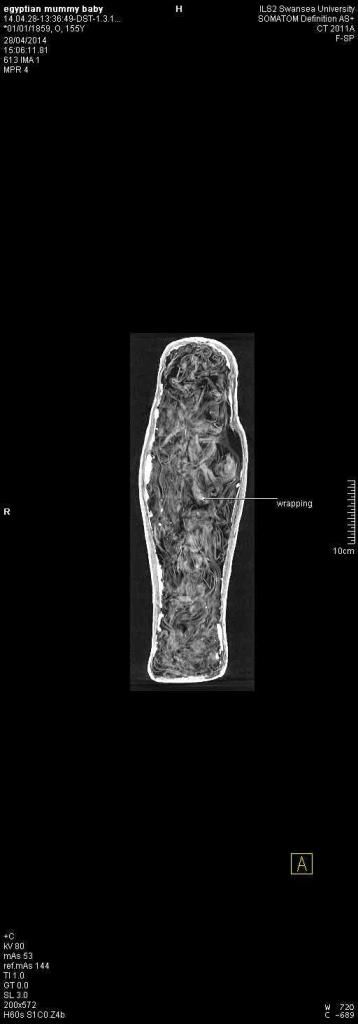 EGYPTIAN MUMMY BABY. CT.THORAX