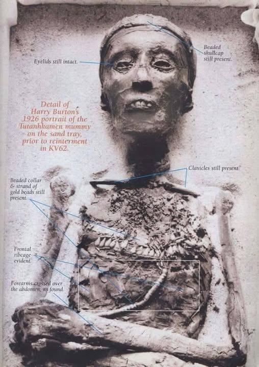 Tutankhamun mummy photo 1926
